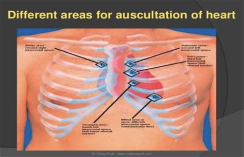 Clin Med II Valvular Disorders Flashcards Quizlet