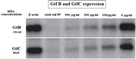 Western Blot Analysis Of Gtfb And Gtfc Enzymes Gtfb And Gtfc Proteins Download Scientific