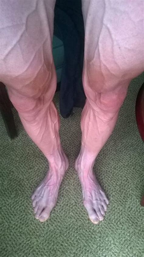 A photo of a cyclist's legs after competing in Tour de France - Sports ...