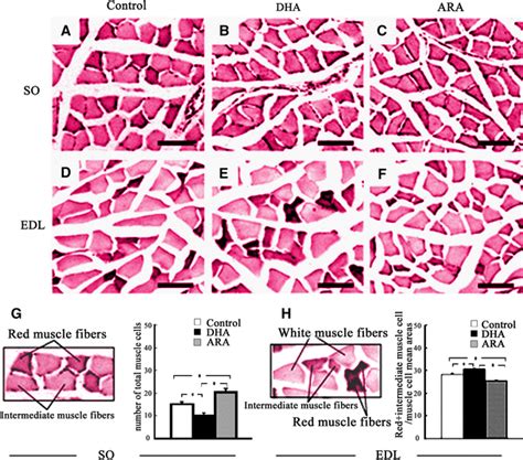 Histological Changes Of Muscle Cell Type SO Slow Twitch Muscle EDL