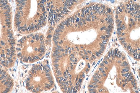 Adhfe1 Antibody 19359 1 Ap Proteintech 武汉三鹰生物技术有限公司