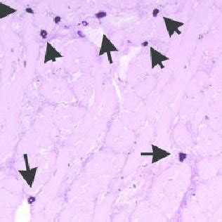 Murine Mast Cells Demonstrate Intense Immunoreactivity For Histamine