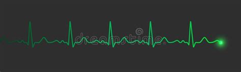 Hartslag Pullmonitor Elektrocardiogram Display Of Vector Medische Kaart