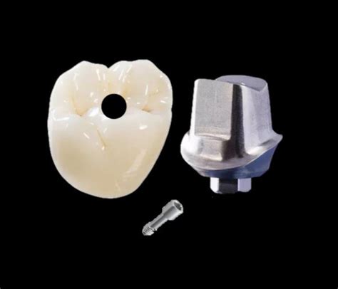 Choosing An Abutment Package Hopetown Dental Lab