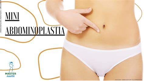 Mini Abdominoplastia O Que Como E Onde Fazer Master Health