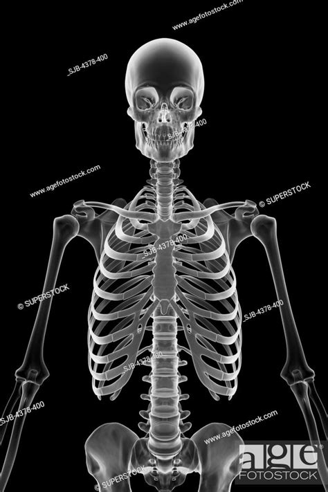 X Ray Of Body