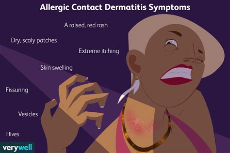 Allergic Contact Dermatitis: Symptoms, Causes, and Treatment