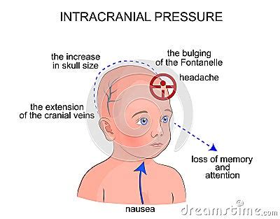 The Symptoms Of Intracranial Pressure In Children Vector Illustration | CartoonDealer.com #71321010