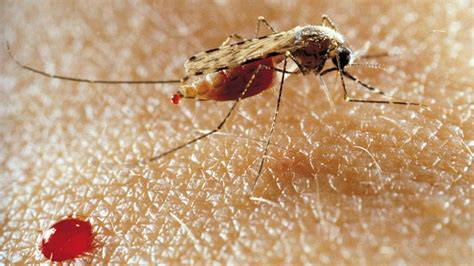 Malaria In Venezuela Ignored By Government Now Threatens