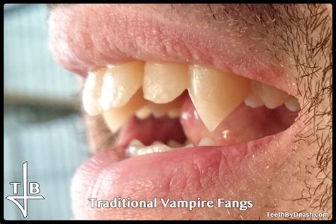 Traditional Vampire Teeth By Dnash