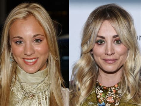 The Refreshing Reason Kaley Cuoco Is Proud Of Her Plastic Surgery