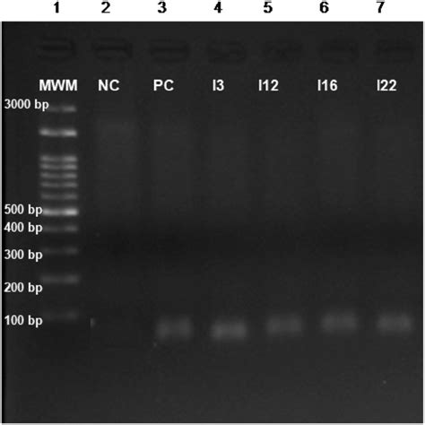 Agarose Gel Electrophoresis Of The Pcr Products Of Arma Gene Lane