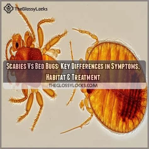 Scabies Vs Bed Bugs: Key Differences in Symptoms, Habitat & Treatment