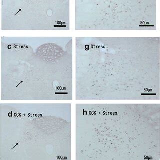 Photomicrographs Of C Fos Immunoreactive Neurons Observed In The Nts