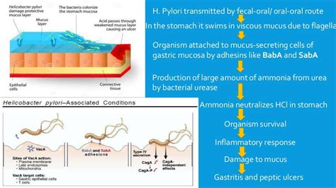 Peptic Ulcer Diagram