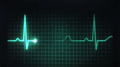 ecg stock footage video shutterstock