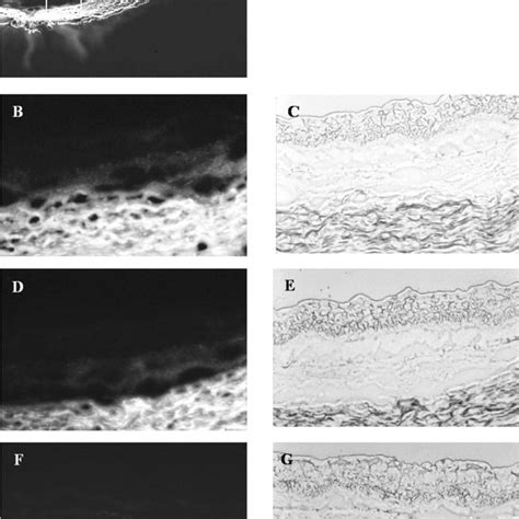 Fluorescence Micrographs And Light Micrographs After Implantation Of