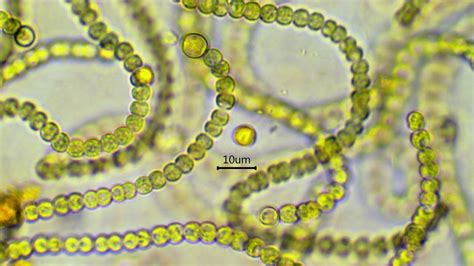 Nostoc Under Microscope