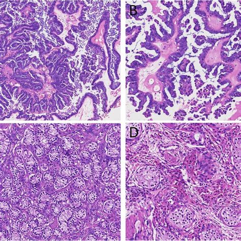 Histological features (hematoxylin and eosin stain). a Microscopic... | Download Scientific Diagram