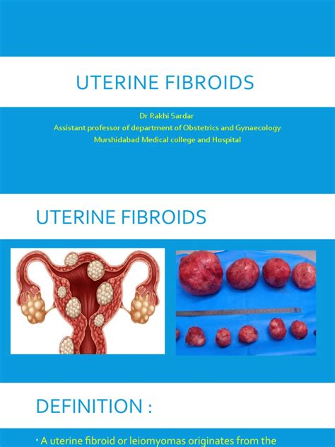 Uterine Fibroids Pdf Gynaecology Human Reproduction