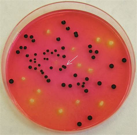 Xylose Lysine Deoxycholate Agar Xld Agar Bijoux Lk