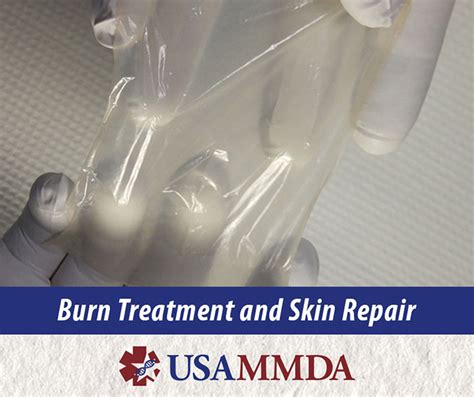 USAMMDA - USAMMDA's Burn Treatment Innovators Continue Future Treatment ...