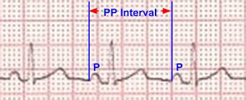 Chapter Management Of Patients With Arrhythmias And Conduction