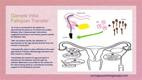 Assisted Reproductive Techniques Ppt