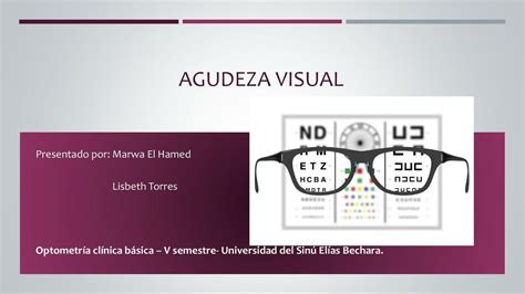 Agudeza Visual Carolina Udocz