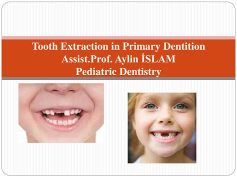 Solution 4 Indications For Primary Tooth Extraction Studypool