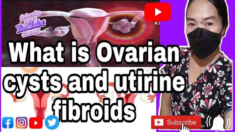 The Difference Between Ovarian Cysts And Utirine Fibroids Youtube