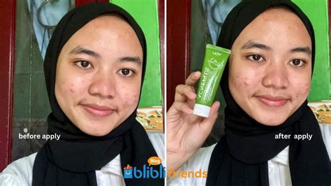 Review You Acne Plus Moisturizer Blibli Friends