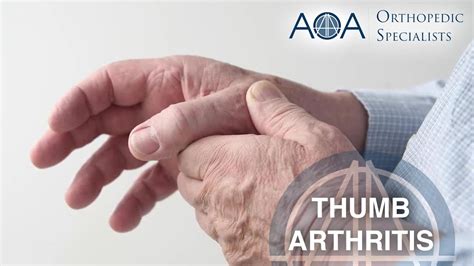 Aoa Orthopedic Specialists Dr Cameron Atkinson Thumb Arthritis