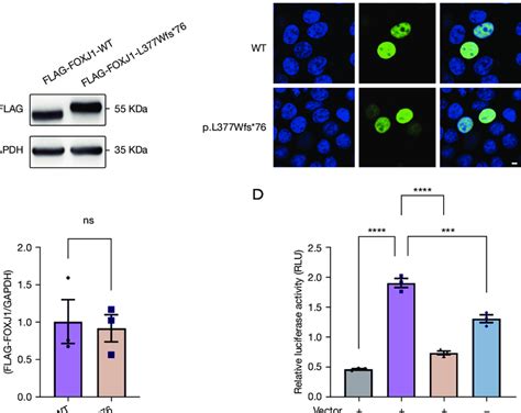 Functional Analysis Of The Wild Type And Mutant FOXJ1 Protein A The