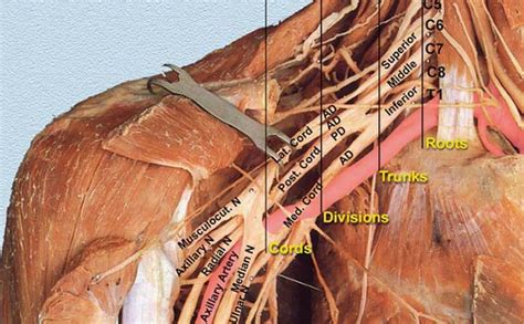 Anatomy of the Brachial Plexus | Anesthesia Key