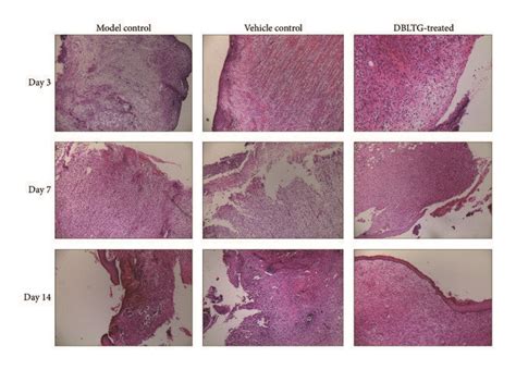 Histological Evaluation Of Wound Granulation Tissue Collected On Day 3 Download Scientific