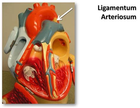 Ligamentum arteriosum, anterior view - The Anatomy of the … | Flickr