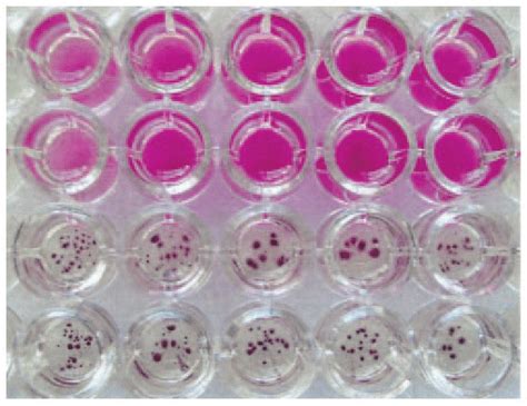 Microplate Of C Krusei Atcc With Stc Showing Objective And