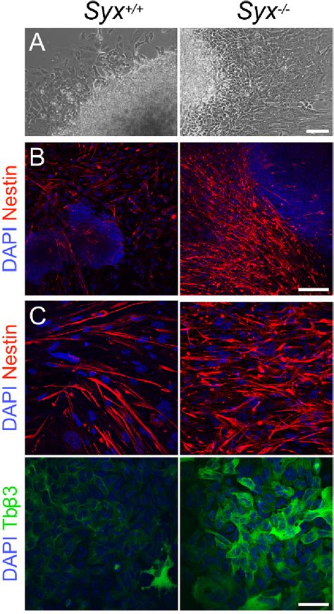 Figure 3 From Analysis Of Retinoic Acid Induced Neural Differentiation