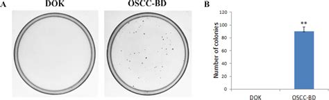 Colony Formation Assay Of Dok And Oscc Bd Cells A In Soft Agar Download Scientific Diagram