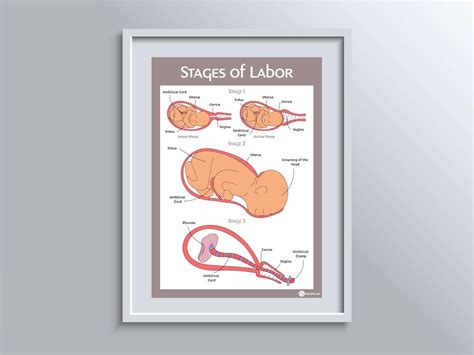 Stages of Labour/labor Educational Poster - Etsy