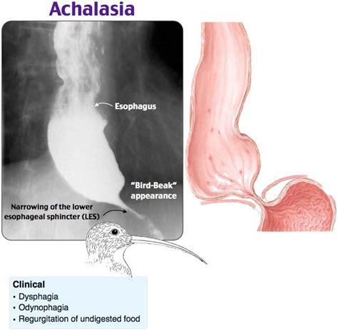 ميد MED on Twitter Medical school stuff Medical radiography