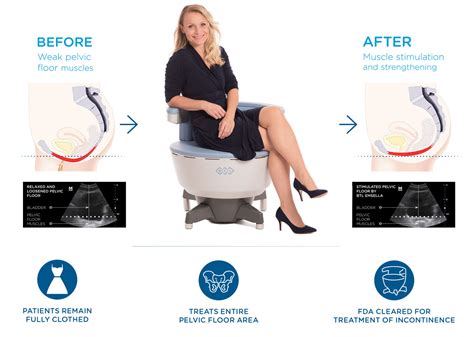 Guide To Pelvic Floor Tightening Using An EmSella Chair