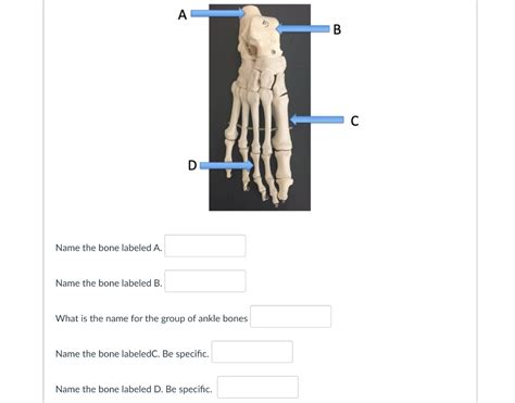 Solved Name the bone labeled A. Name the bone labeled B. | Chegg.com