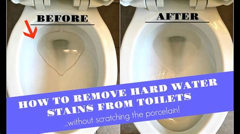 How To Remove Hard Water Stains From Toilets Without Scratching The