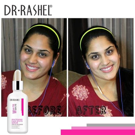 Dr Rashel Whitening Fade Spots Serum Dr Rashel Official