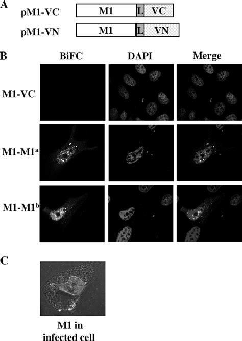 Comparative Studies Of M1 Localization Patterns Between Transient