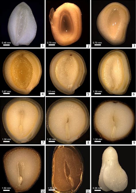 The development of tree peony seeds. Figure 3-1 10 days after anthesis ...