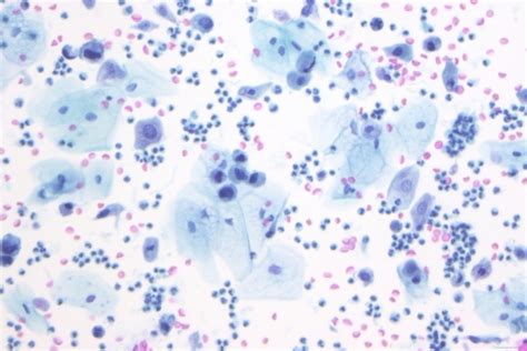 Cytology Ottawa Atlas Of Pathology