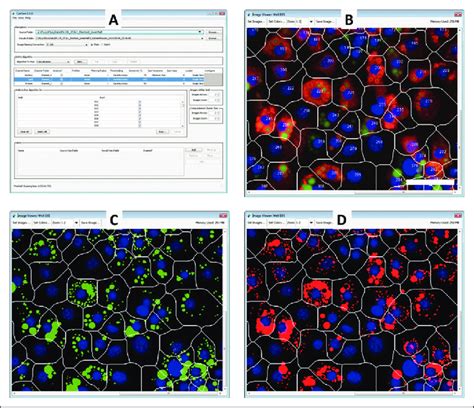 High Content Analysis Of Lipid Droplets And Associated Proteins By